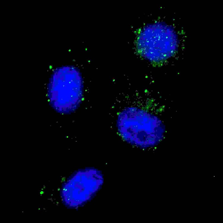 Anti-Beclin 1 Antibody