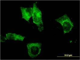 Anti-CEL Antibody