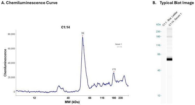 Human serum 20X | Secondary Ab: Mouse | Exposure: 5 sec | Expected MW (kDa): 45.3