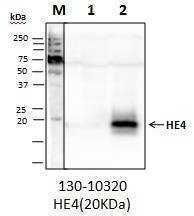 Anti-HE4 Antibody