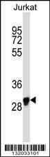 Anti-OR1N1 (C-term) Antibody