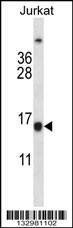 Anti-BCL2 (Center) Antibody