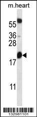 Anti-BCL2 (Center) Antibody