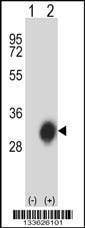 Anti-HLA-DPB1 (Center) Antibody