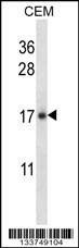 Anti-IL21 (C-term) Antibody