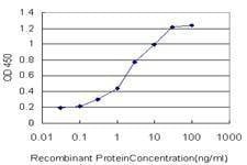 Anti-CENPJ Antibody