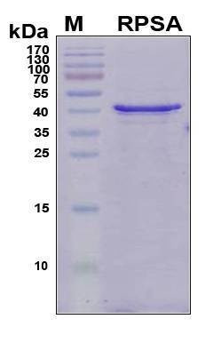 Recombinant Human Ribosomal Protein SA, Antigen Grade
