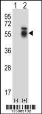 Anti-ACVR1 (Center) Antibody