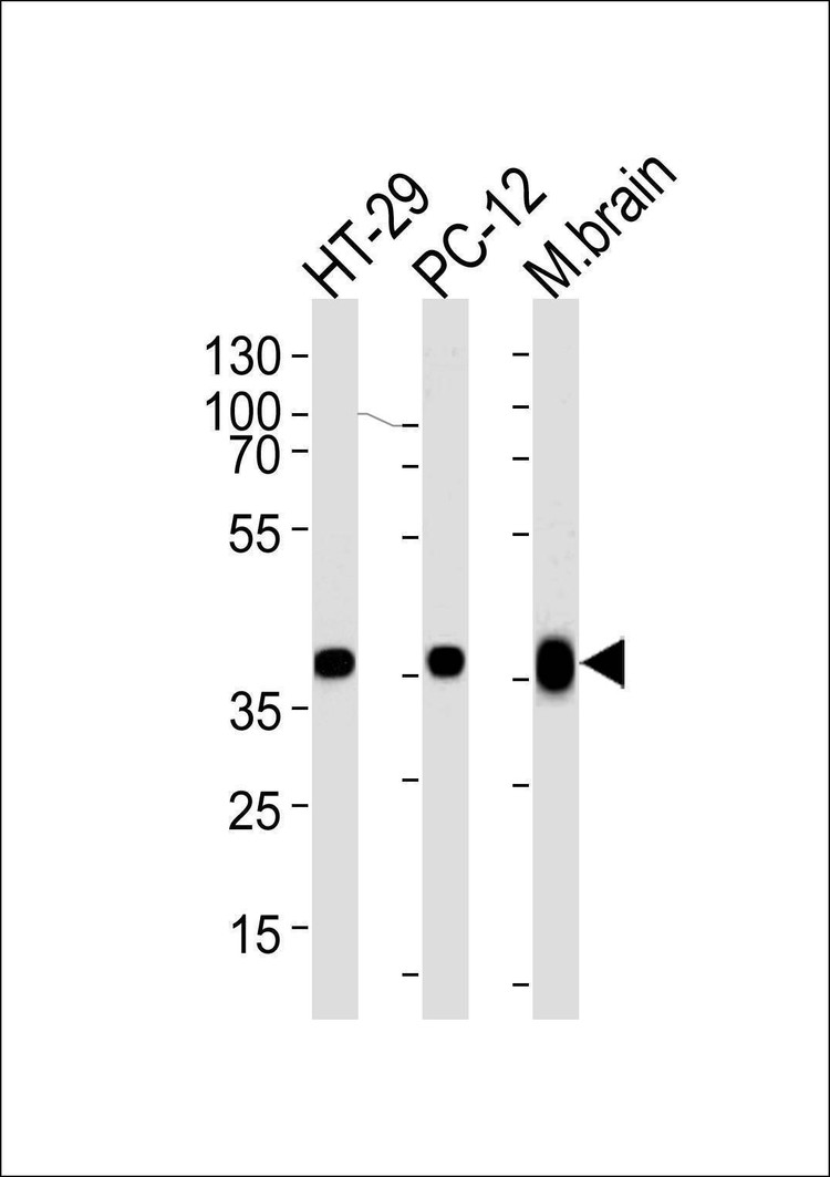 Anti-PPP1CB (C-term) Antibody