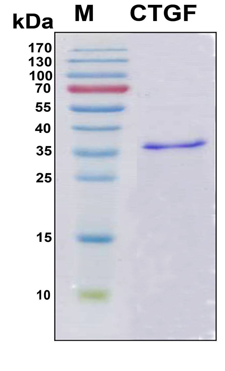Recombinant Human CTGF Protein, Antigen Grade