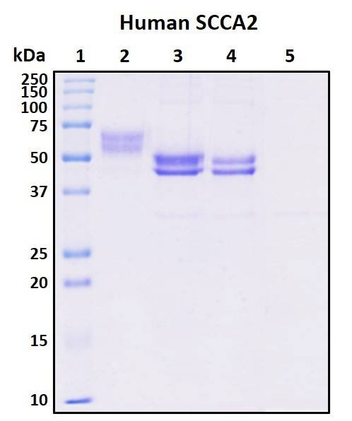 Recombinant Human SCCA2 (Serpin B4) Protein