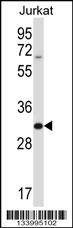 Anti-HRASLS5 (Center) Antibody