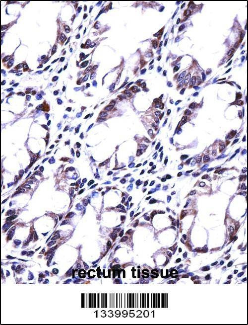 Anti-HRASLS5 (Center) Antibody