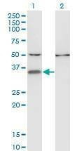 Anti-CENPV Antibody