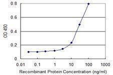 Anti-CENPV Antibody