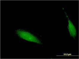 Anti-CENPV Antibody
