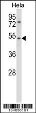 Anti-CHRNA7 (N-term) Antibody