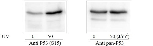 Human/Mouse/Rat p53 (S15) Cell-Based ELISA Kit