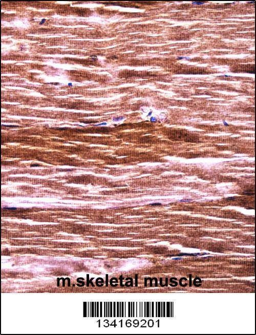 Anti-Akt2 (N-term) Antibody