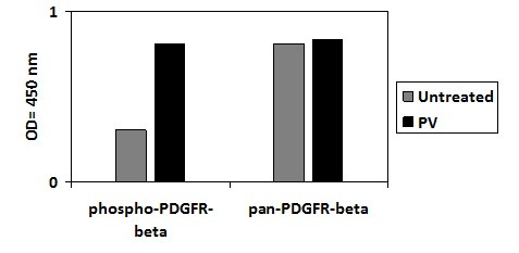 Human Phospho-PDGFR-beta (Y751) ELISA Kit
