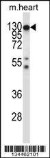 Anti-Csf1r (C-term) Antibody