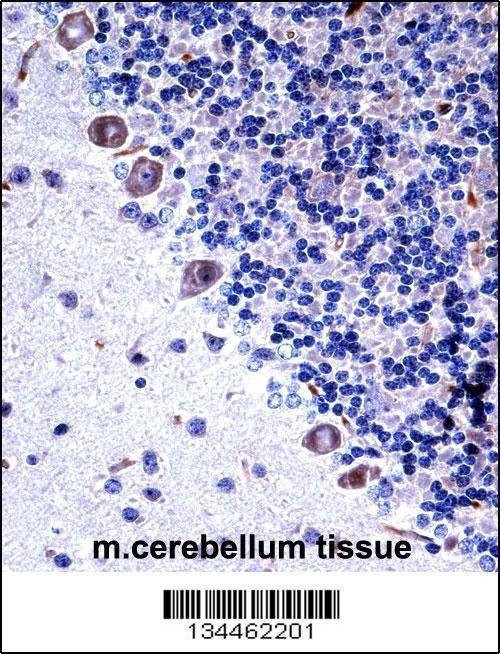 Anti-Csf1r (C-term) Antibody