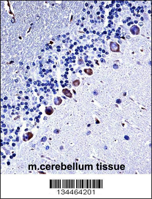 Anti-Mouse Csnk1g3 (C-term) Antibody