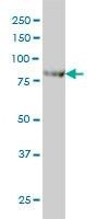 Anti-CENTB2 Antibody