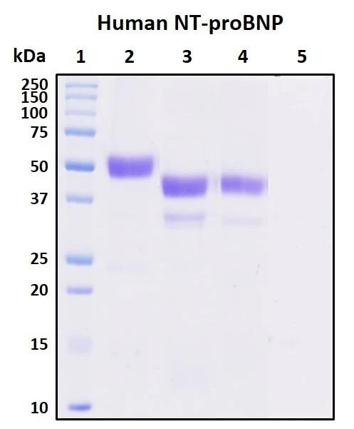 Recombinant Human NT-proBNP Protein