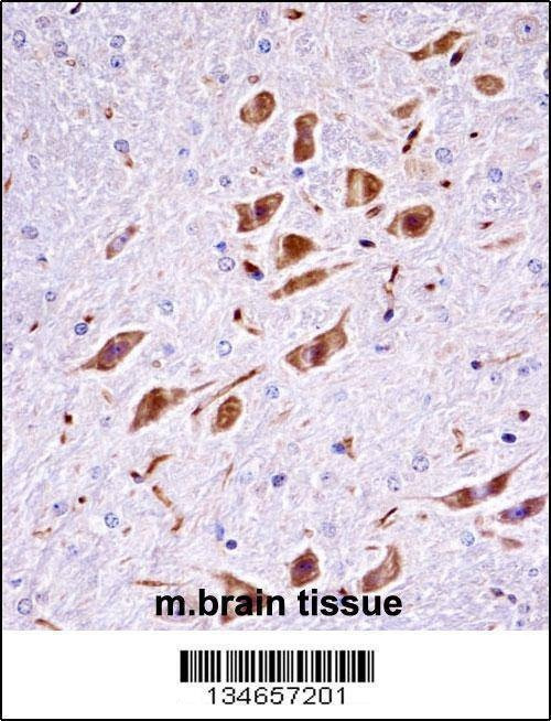 Anti-Mouse Pak3 (N-term) Antibody