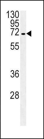Anti-SLC22A1 (C-term) Antibody