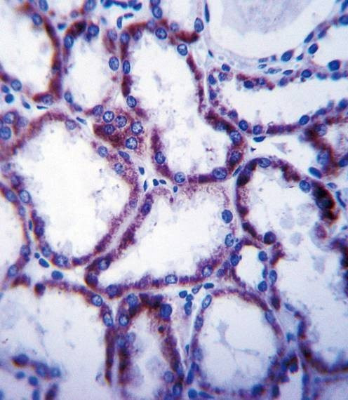 Anti-SLC22A1 (C-term) Antibody