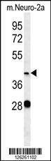 Anti-VASH2 (C-term) Antibody