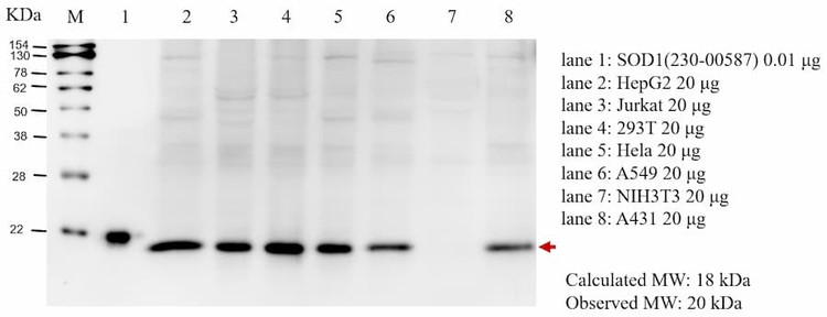 Anti-SOD1 Antibody