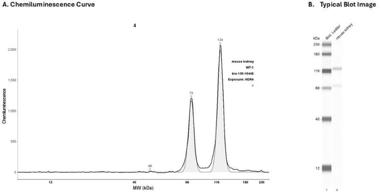 Protein:Mouse kidney | Secondary Ab: Mouse | Exposure: HDR4 | Expected MW (kDa): 49