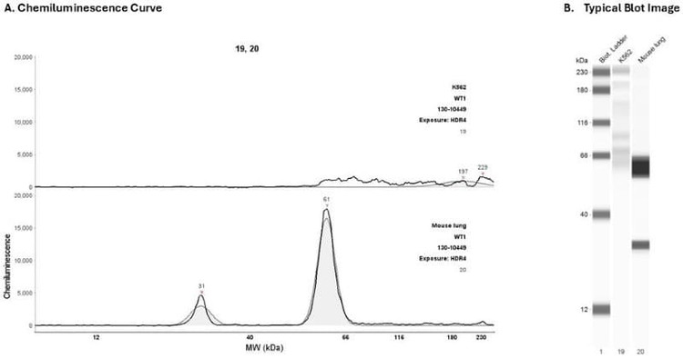 Cell Lysate: K562; mouse lung | Secondary Ab: Mouse | Exposure: HDR4 | Expected MW (kDa): 49