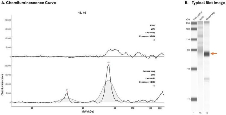 Cell Lysate: K562; mouse lung | Secondary Ab: Mouse | Exposure: HDR4 | Expected MW (kDa): 49