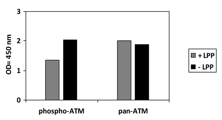 Human Phospho-ATM (S1981) ELISA Kit