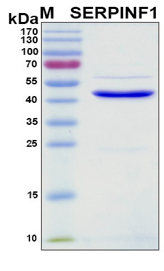Recombinant Mouse Serpin F1 (PEDF) Protein
