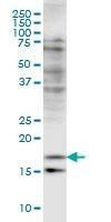 Anti-CFL2 Antibody