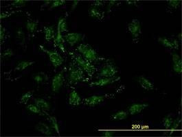 Anti-CFL2 Antibody