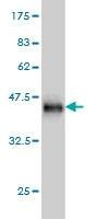 Anti-CFL2 Antibody