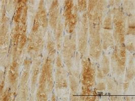 Anti-CFL2 Antibody