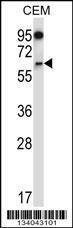Anti-NOX4 (N-term) Antibody