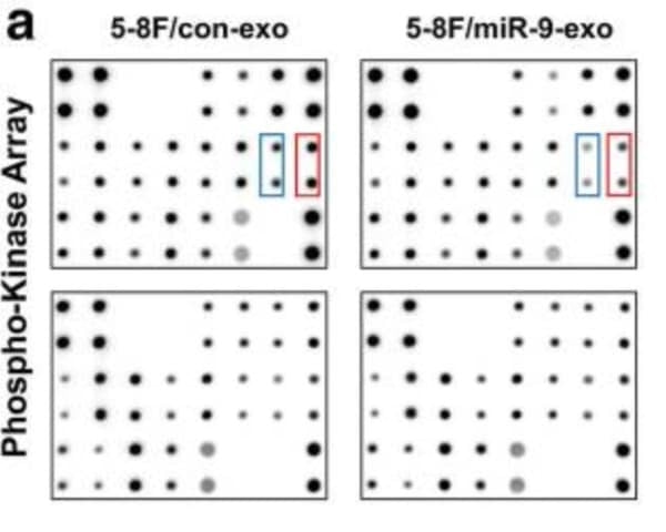 RayBiotech's AKT Pathway Phosphorylation Antibody Array was used to assess exosomal miR-9's effects on PDK/AKT signaling in endothelial cells. Figure adapted from Lu et al., J Exp Clin Cancer Res, 2018.