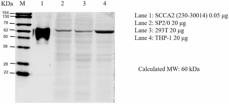 Anti-SCCA2 Antibody
