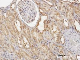 Anti-CFLAR Antibody