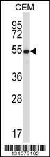 Anti-GABPA (Center) Antibody