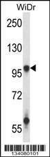 Anti-GRIA3 (N-term) Antibody