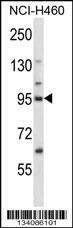 Anti-KIF2C (N-term) Antibody